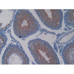 Lactate Dehydrogenase C (LDHC) Antibody