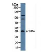 Western blot analysis of Rat Serum.