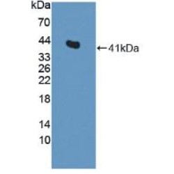 Centaurin Alpha 2 (CENTa2) Antibody