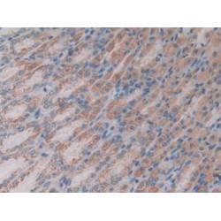 Centaurin Alpha 2 (CENTa2) Antibody