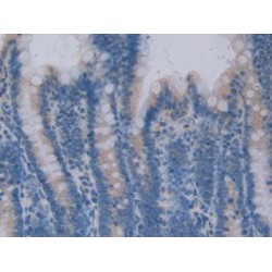 Centaurin Alpha 2 (CENTa2) Antibody