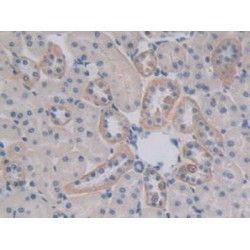 Centaurin Alpha 2 (CENTa2) Antibody