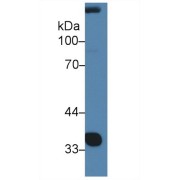 Western blot analysis of Rat Serum, using Rat NOV Antibody (2 µg/ml) and HRP-conjugated Goat Anti-Rabbit antibody (<a href="https://www.abbexa.com/index.php?route=product/search&amp;search=abx400043" target="_blank">abx400043</a>, 0.2 µg/ml).