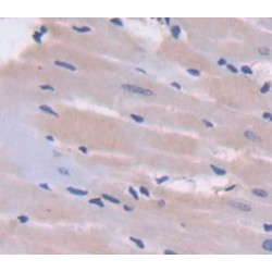 Nephroblastoma Overexpressed Gene (NOV) Antibody