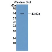 Western blot analysis of the recombinant protein.