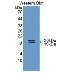 Fatty Acid Binding Protein 9, Testis (FABP9) Antibody