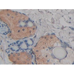 Fatty Acid Binding Protein 9, Testis (FABP9) Antibody