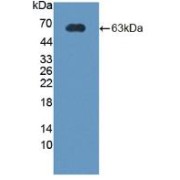 Western blot analysis of recombinant Rat CRHBP.