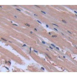 Corticotropin Releasing Hormone Binding Protein (CRHBP) Antibody