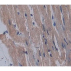 Intestinal Cell Kinase (ICK) Antibody