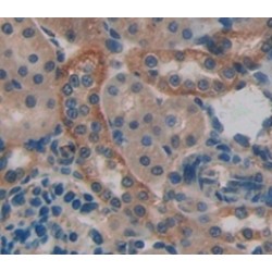 Low Density Lipoprotein Receptor Related Protein 5 (LRP5) Antibody