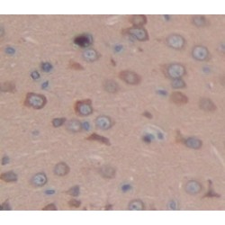 Echinoderm Microtubule Associated Protein Like Protein 2 (EML2) Antibody