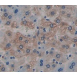 Insulin Receptor Substrate 3 (IRS3) Antibody