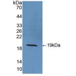 Superoxide Dismutase 1 (SOD1) Antibody