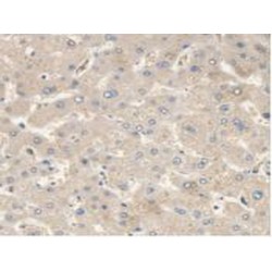 Malic Enzyme 2, NADP+ Dependent, Mitochondrial (ME2) Antibody