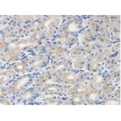 Malic Enzyme 2, NADP+ Dependent, Mitochondrial (ME2) Antibody