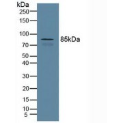 Western blot analysis of Human Serum.