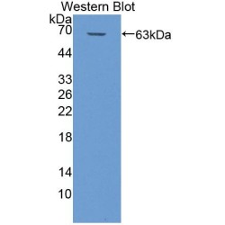 Microtubule Associated Protein 4 (MAP4) Antibody