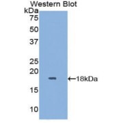 Western blot analysis of the recombinant protein.