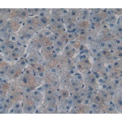 T-Cell Lymphoma Invasion And Metastasis Inducing Protein 1 (TIAM1) Antibody