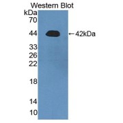 Western blot analysis of the recombinant protein.