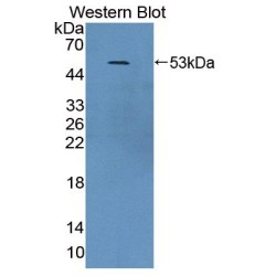 Mitochondrial Translational Initiation Factor 2 (MTIF2) Antibody