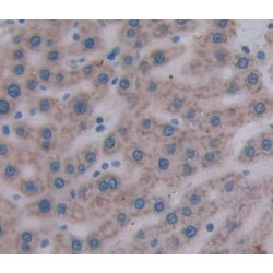 Mitochondrial Translational Initiation Factor 2 (MTIF2) Antibody