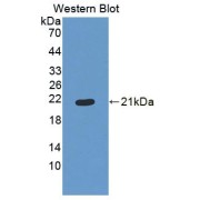 Western blot analysis of the recombinant protein.