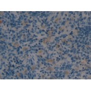 IHC-P analysis of Rat Spleen Tissue, with DAB staining, using Ang1-7 Antibody (5 µg/ml) and HRP-conjugated Goat Anti-Rabbit antibody (<a href="https://www.abbexa.com/index.php?route=product/search&amp;search=abx400043" target="_blank">abx400043</a>, 0.2 µg/ml).