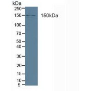 Western blot analysis of Human A431 cells.