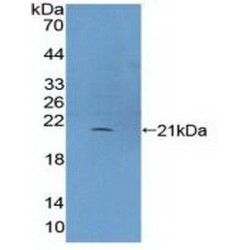 Phospholipase C Beta 3, Phosphoinositide Specific (PLCb3) Antibody