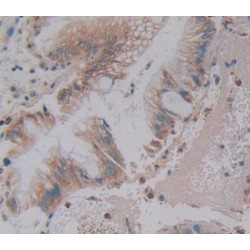 Phospholipase C Beta 3, Phosphoinositide Specific (PLCb3) Antibody