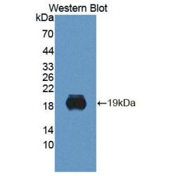 Bisphosphoglycerate Mutase (BPGM) Antibody