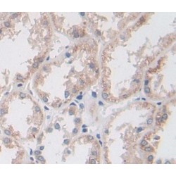 Bisphosphoglycerate Mutase (BPGM) Antibody