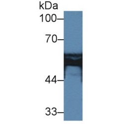 Hydroxymethylglutaryl-CoA Synthase, Mitochondrial (HMGCS2) Antibody