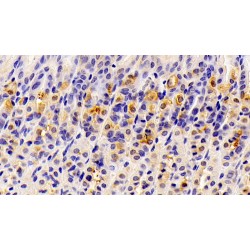 Hydroxymethylglutaryl-CoA Synthase, Mitochondrial (HMGCS2) Antibody