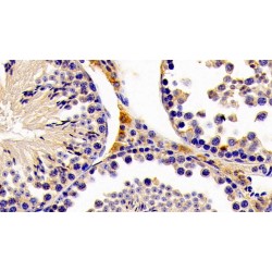 Hydroxymethylglutaryl-CoA Synthase, Mitochondrial (HMGCS2) Antibody