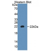 Western blot analysis of recombinant Mouse a4GALT.