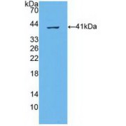 Western blot analysis of recombinant Human ABCA4.