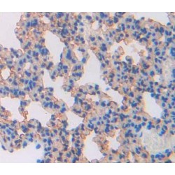 ATP Binding Cassette Subfamily A Member 8 (ABCA8) Antibody