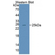 Western blot analysis of the recombinant protein.