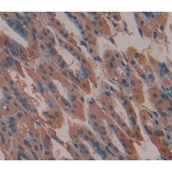 ATP Binding Cassette Transporter A9 (ABCA9) Antibody