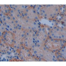 ATP Binding Cassette Subfamily B Member 10 (ABCB10) Antibody