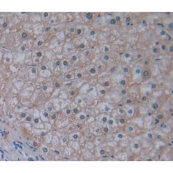 ATP Binding Cassette Subfamily B Member 10 (ABCB10) Antibody