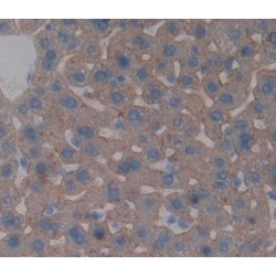 ATP Binding Cassette Transporter B4 (ABCB4) Antibody