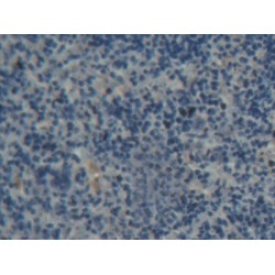 ATP Binding Cassette Transporter B8 (ABCB8) Antibody