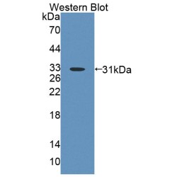 ATP Binding Cassette Transporter B8 (ABCB8) Antibody