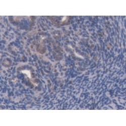 ATP Binding Cassette Transporter B8 (ABCB8) Antibody