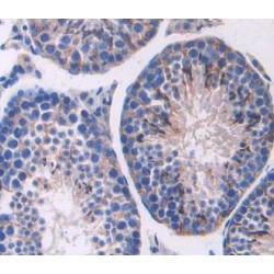 ATP Binding Cassette Transporter C11 (ABCC11) Antibody