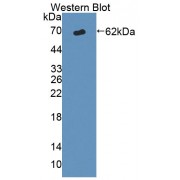 Western blot analysis of the recombinant protein.